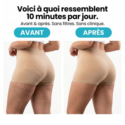 Masseur Rotatif Anti-Cellulite - SŌMA